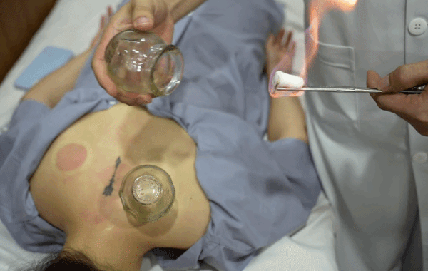 'Mỏ vàng' chưa khai phá của y học cổ truyền Việt Nam